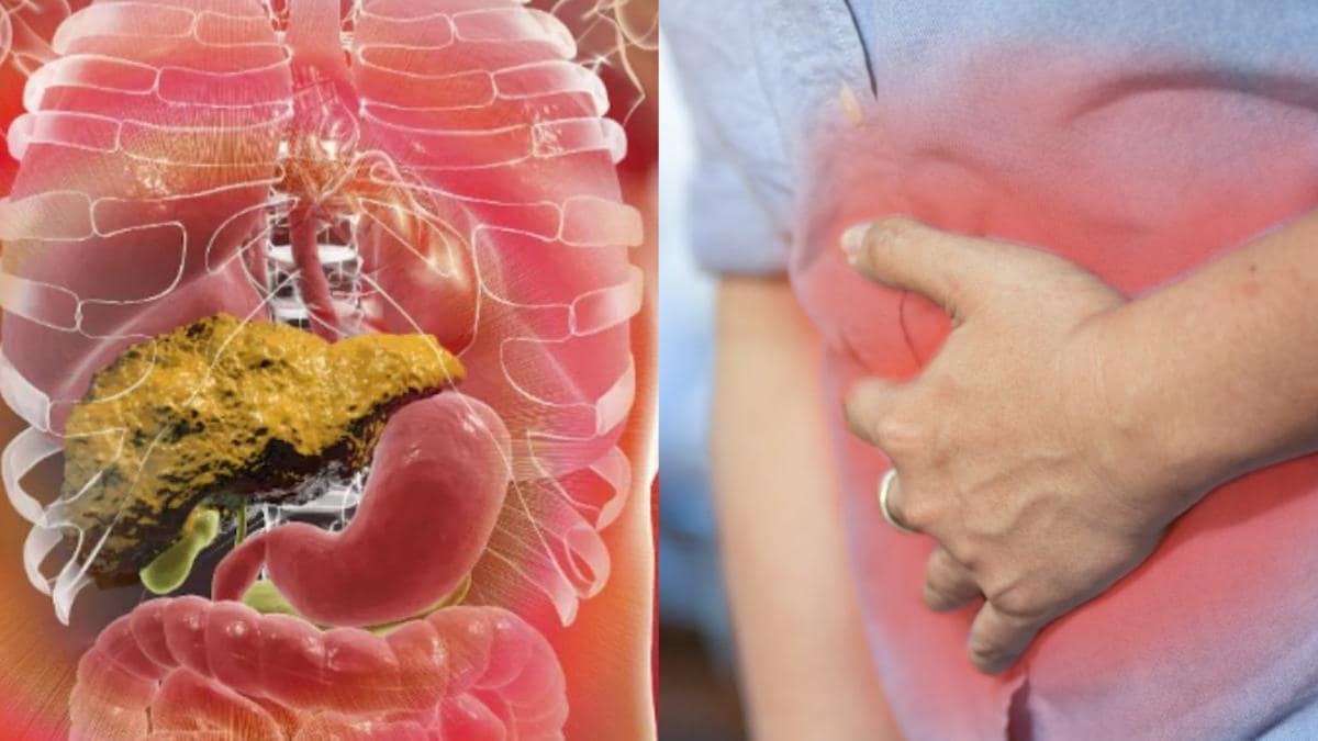 फैटी लिवर से हैं परेशान तो करें ये उपाय 