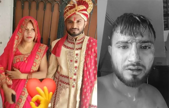 बांग्लादेश से आई जूली ने हिंदू बनकर की शादी, फिर पति को ले गई  साथ, अब परिजन को भेज रही खून से लथपथ फोटो  